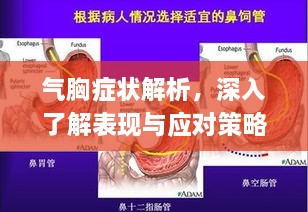 氣胸癥狀解析，深入了解表現(xiàn)與應對策略