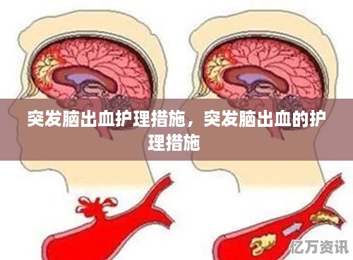 突發(fā)腦出血護(hù)理措施，突發(fā)腦出血的護(hù)理措施 