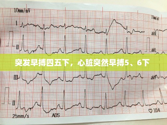 突發(fā)早搏四五下，心臟突然早搏5、6下 