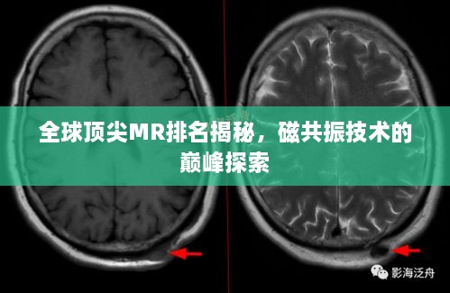 全球頂尖MR排名揭秘，磁共振技術(shù)的巔峰探索