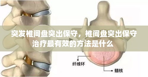 突發(fā)椎間盤突出保守，椎間盤突出保守治療最有效的方法是什么 