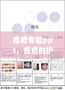 痤瘡專題ppt，痤瘡的護(hù)理ppt 