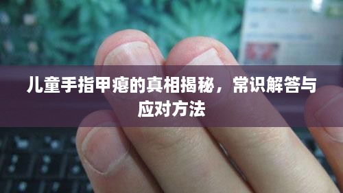 兒童手指甲癟的真相揭秘，常識解答與應(yīng)對方法