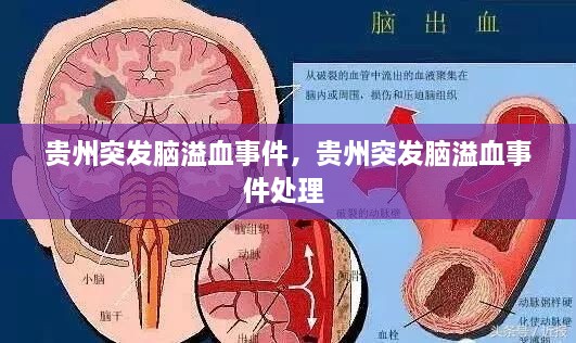 貴州突發(fā)腦溢血事件，貴州突發(fā)腦溢血事件處理 